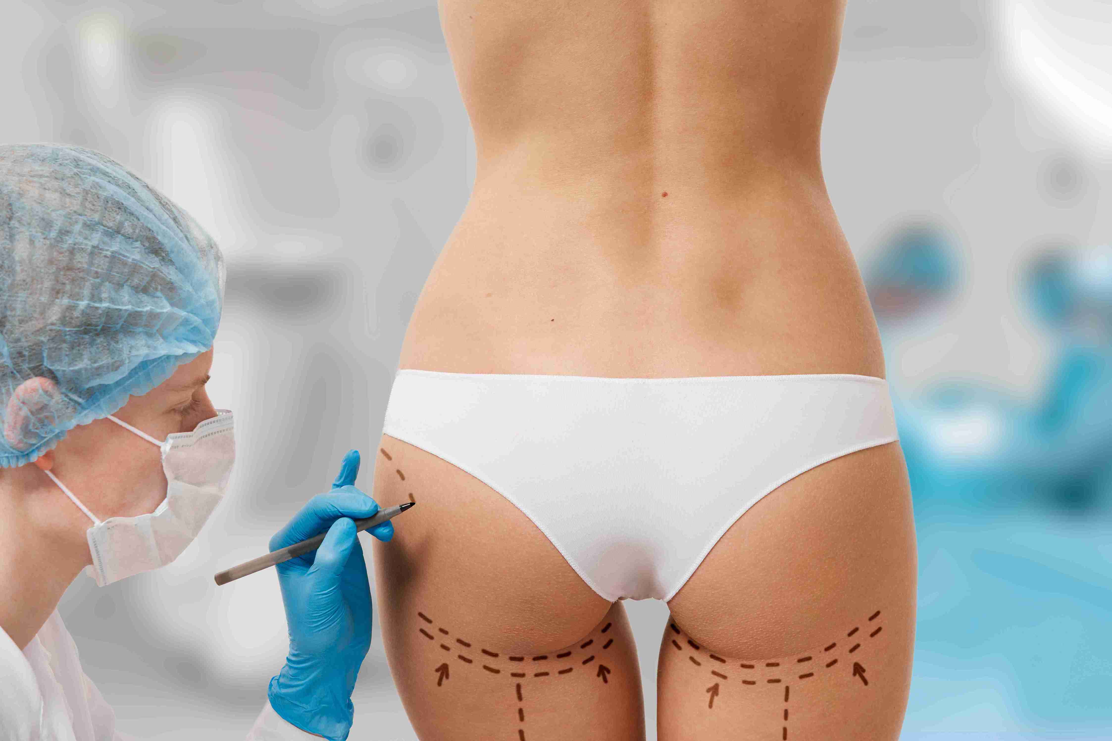 Buttock Augmentation - Buttock Implants